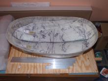 Kompletní odstranění žeber